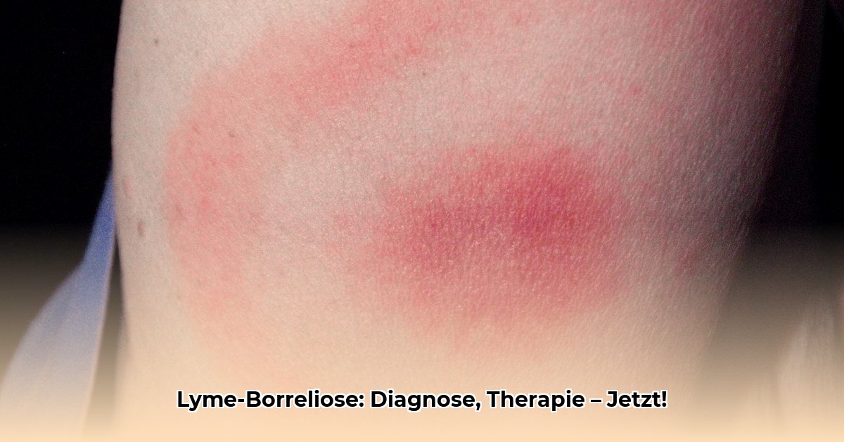 lyme-krankheit